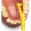 Tepe TePe Angle Yellow Interdental Brushes (0.7mm - Size 4) / Easy and simple interspace cleaning with long handle and angled neck / 1 x 6 brushes 7