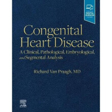 Congenital Heart Disease