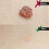 Auto Skin Tag Remover Kit 2