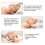 (1.0MM) Derma Roller Micro Needle Titanium Tips Mesoroller Body Face Treatment 7