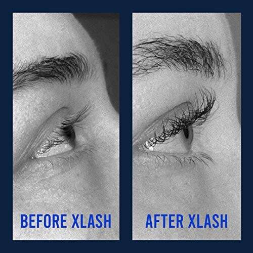 Xlash Lash Serum 3ml - Longer Lashes in 30 Days 2