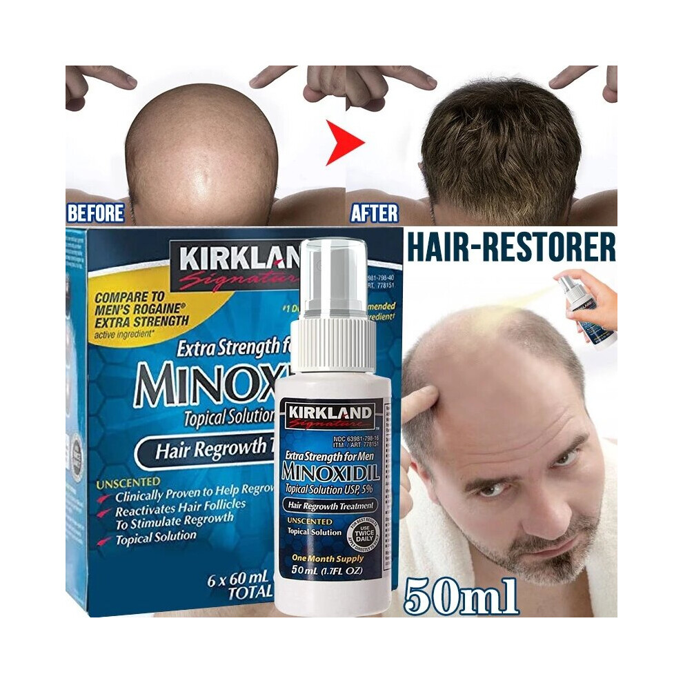 50ml Hair Growth Essence Spray Hair Loss Product Hair Regrow Spray