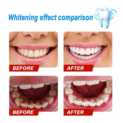 (Passion Fruit) Baking Soda Toothpaste Stain Removal Whitening Toothpaste Fight Bleeding Gums 2