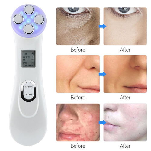 (White without box) Face Mesotherapy RF Radio Frequency Lift Massager 1