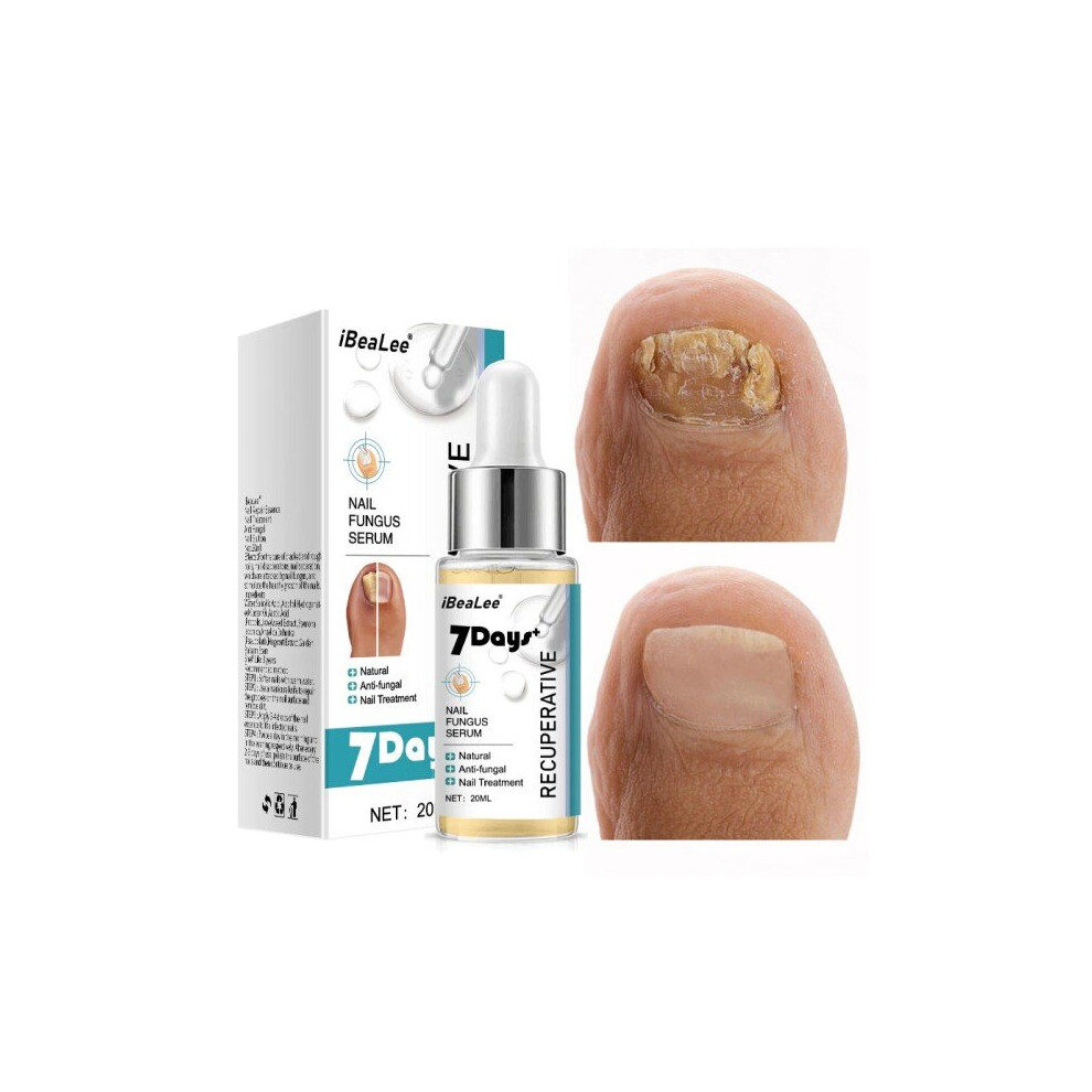 7DAYS Repair Nail Fungus Treatments Essence Foot Care Serum