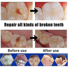 Repair Cement Teeth Gap Falseteeth Solid Glue Set Tooth Filling Kit Temporary Dental Fake Teeth Glue Tooth Gaps