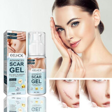 Powerful Scar Removal Cream Acne Spots Burn Surgical Scar Stretch Mark Treatment Repair Gel Whiten Nourish Smooth Body Skin Care