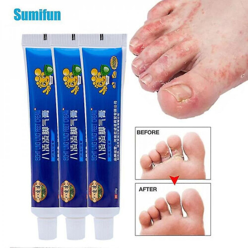3pcs Athlete's Foot Treatment Cream Remove Odor Foot Anti-itching  Antibacterial Ointment Beriberi Peeling Blisters Care Plaster on OnBuy