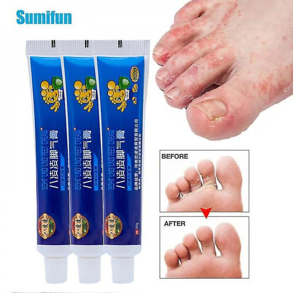 3pcs Athlete's Foot Treatment Cream Remove Odor Foot Anti-itching Antibacterial Ointment Beriberi Peeling Blisters Care Plaster