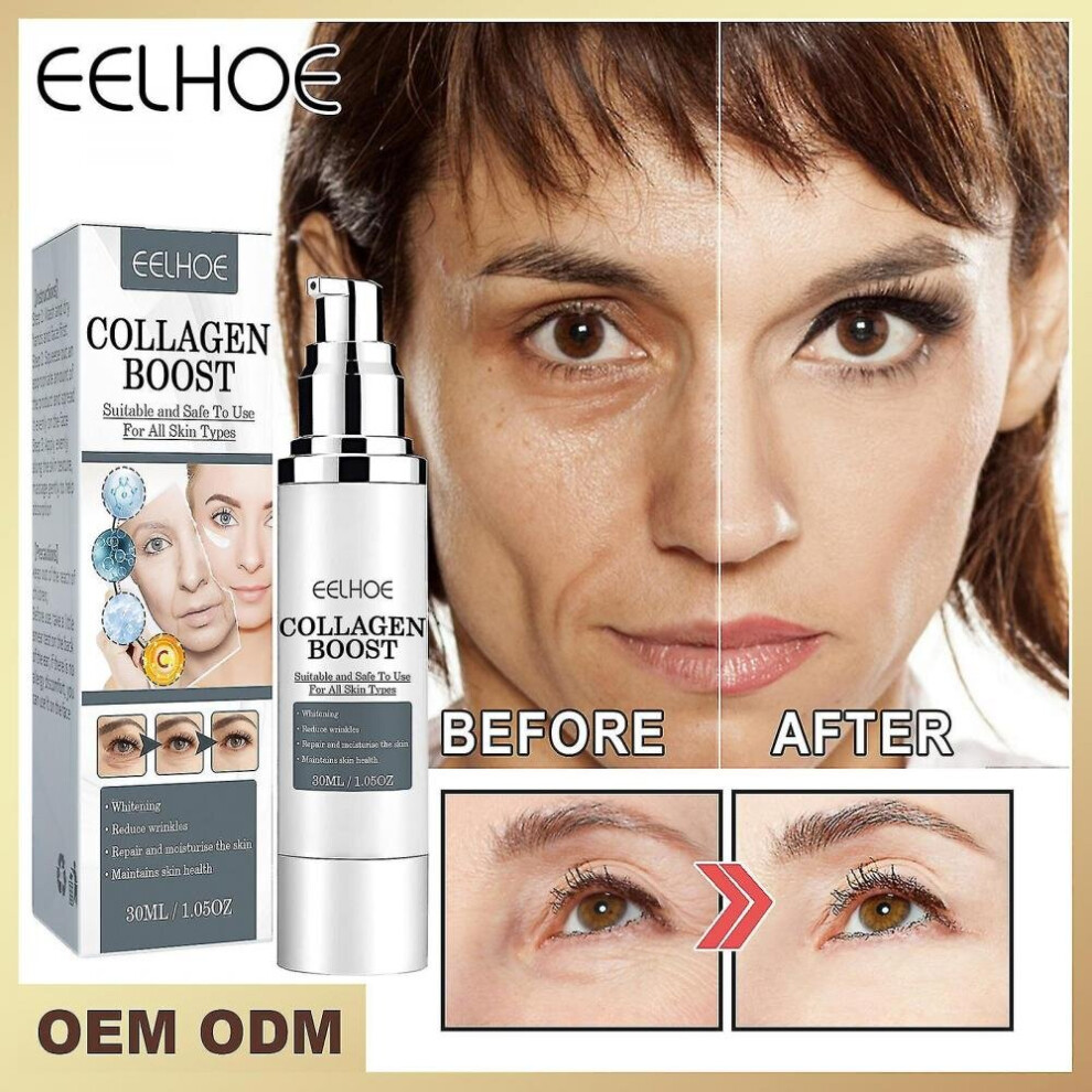 Eelhoe Collagen Anti-wrinkle Cream Collagen Age-defying Restructuring To Reduce Fine Lines, Moisturise And Firm The Skin 30ml Box