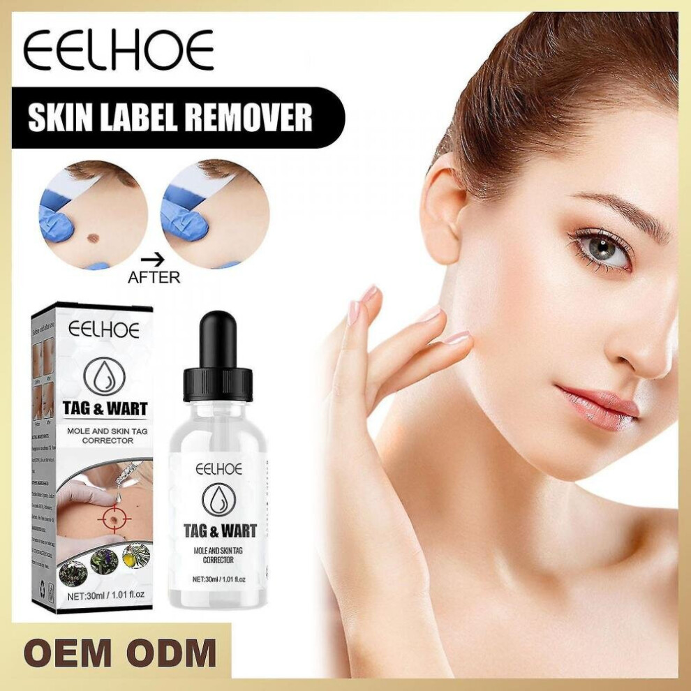 Mole Removal Serum Mole Removal Solution Mole Removal Fluid Skin Dark Mole Spot Flesh Mole Flattened Keratosis Repair Serum 30ml