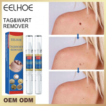 Skin Wart Removal Pen Mole Remover Body Wart Treatment Skin Repair Treatment s Box
