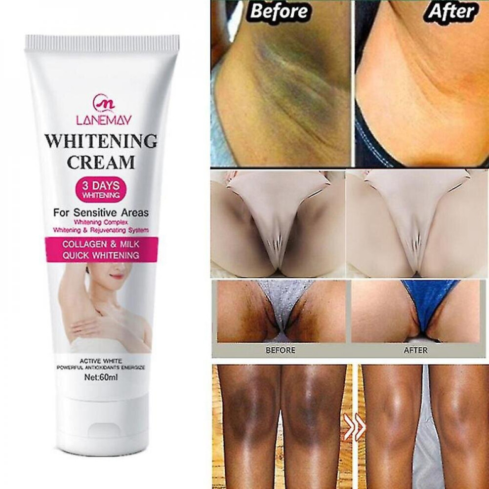 Women's Private Parts Underarm Whitening Cream Brightening Cream Sensitive Parts Whitening And Darkening Armpit Beauty Cream