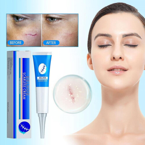 Eelhoe 20g Scar Removal Cream Repairs Skin, Fades Scars, Smoothes Skin ...