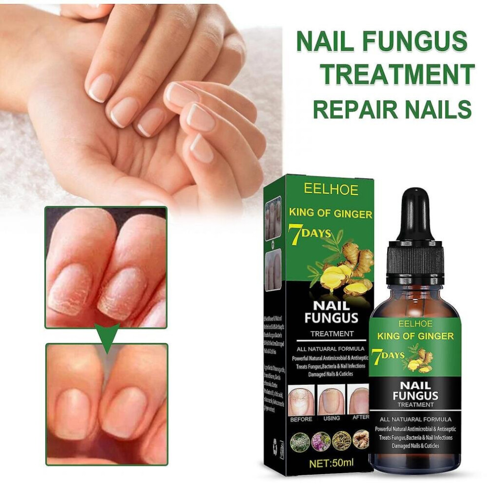 Eelhoe Nail Repair Fluid 50ml