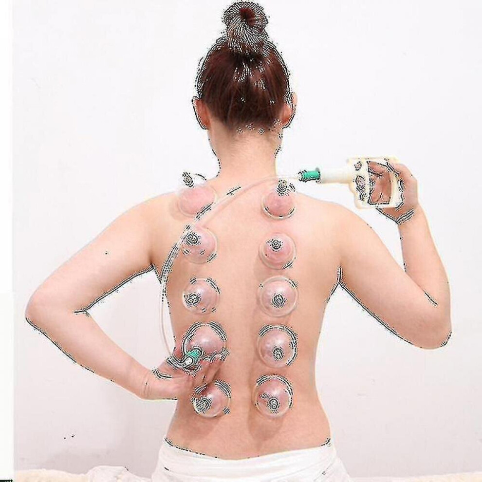 Hkhbjs In Stock 12Pcs-Set Vacuum Cupping Set Massager Cans Suction Cups Set