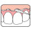Tepe Tepe Bridge & Implant Floss 3