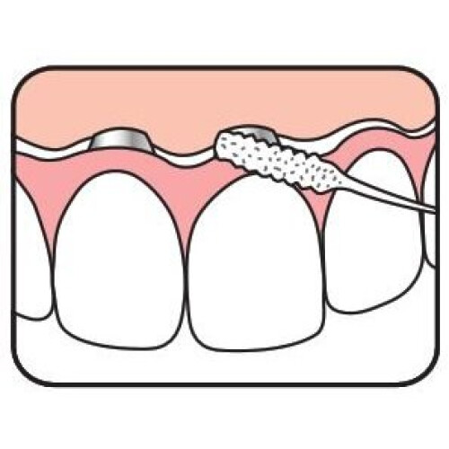 Tepe Tepe Bridge & Implant Floss 2