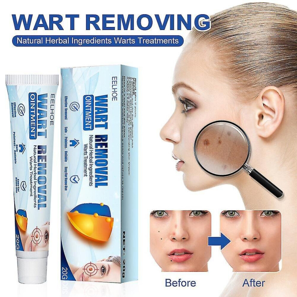 Huacreate Skin Tag Remover Cream Safe And Effective Skin Tag, Wart, Callus, Milia Remover Scar-free Cream For Men Women