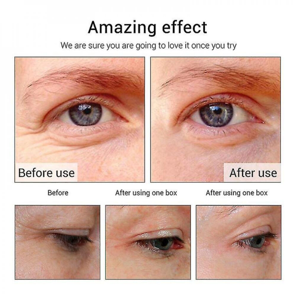 Auquest Peptides Anti Wrinkle Dark Circle Eye Cream Hyaluronic Acid Serum Gel For Firming Whitening Puffy Eye Care 20g