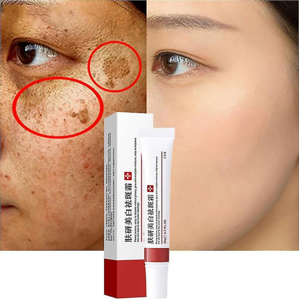 Booster Whitening Freckle Cream Remove Dark Spots Anti-acne Anti Freckle Fade Pigmentation Remover Melasma Brighten Creams Skin Care