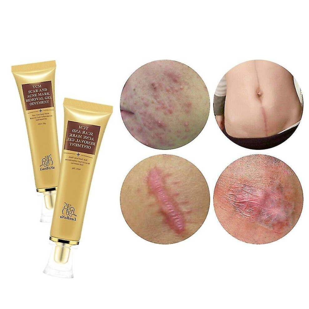 Acne Scar Removal Cream, Skin Repair Face Spots