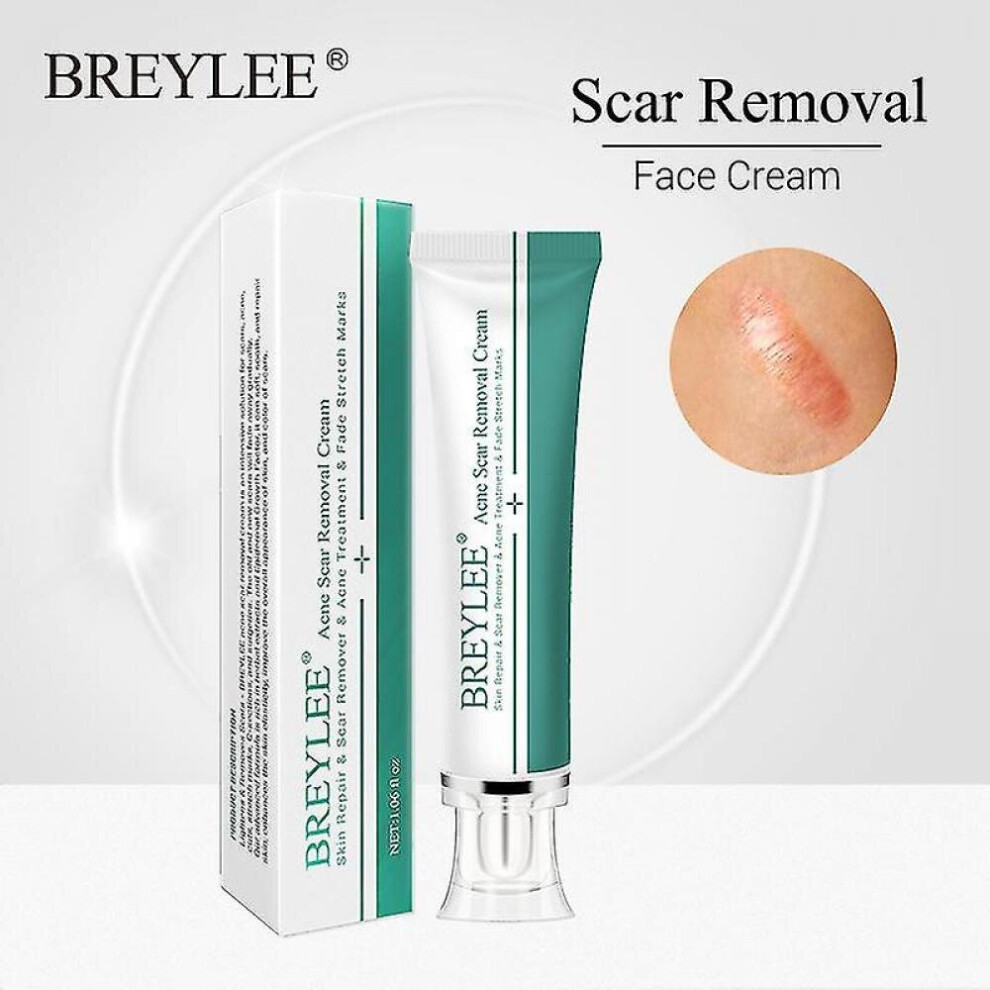 Breylee Acne Scar Removal Cream 30g Face Cream Skin Repair Skin Care Scar Acne Treatment Remove Stretch Marks Whitening Cream