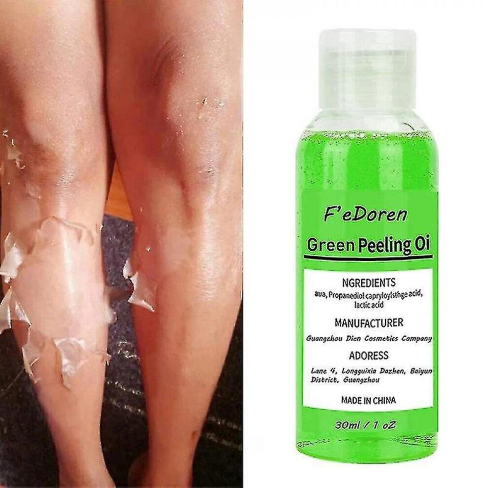 Ultra Strong Green Exfoliating Oil Whitening Exfoliating Body Whitening Skin 50ml