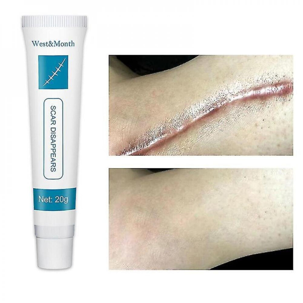 Scar Repair Cream Acne Scar Removal Pigmentation Corrector Remove Stretch Marks Smooth Skin Whitening Scar Face Care