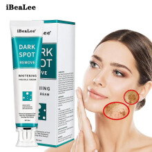 Ibealee Whitening Freckle Cream Remove Melasma Acne Spot Pigment Melanin Dark Spots Whitening Moisturizing Cream Skin Care