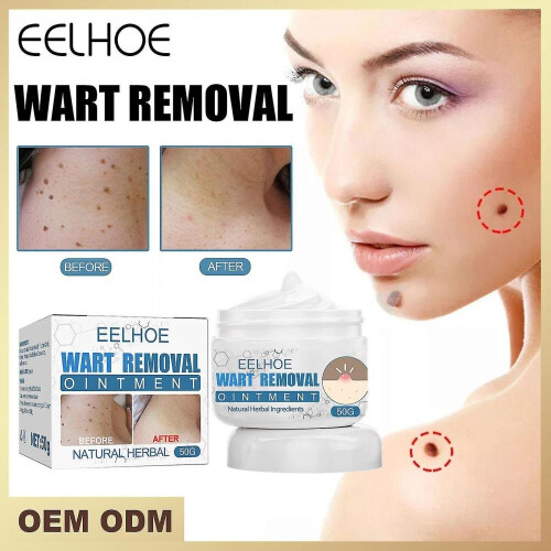 Wart Cream Skin Cleansing Wart Flattening Cream Facial Flat Wart Wart ...