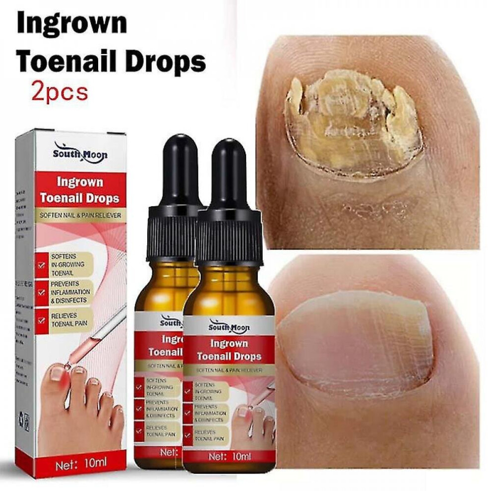 2pcs Nail Fungal Treatment Feet Care Serum Anti Infection Paronychia Onychomycosis Nails Toe Nail Fungus Removal Health Products