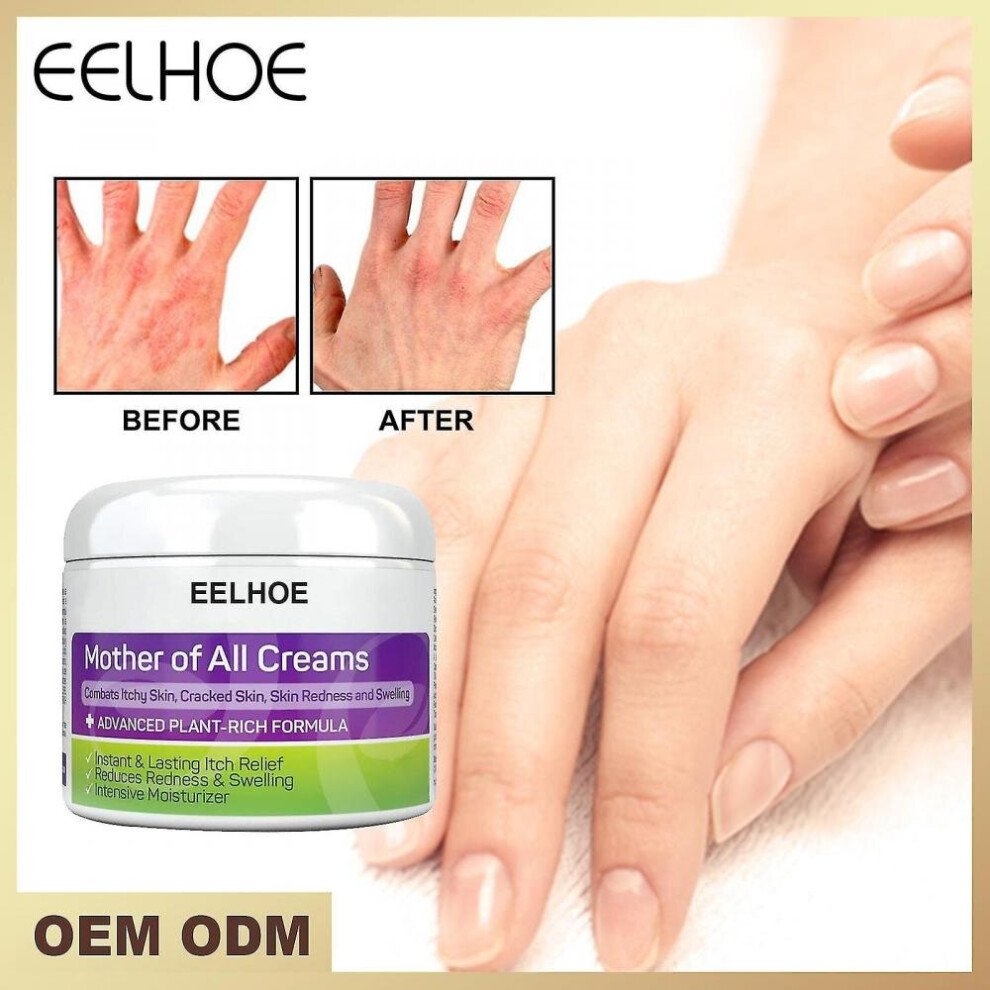 Skin Itch Relief Treatment Cream Body Hydration Repair Nourishing Cream Hand Foot Moss Skin Treatment Cream 30g