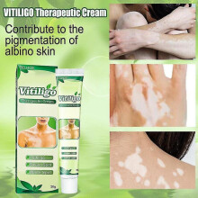 White Tag Treatment Moisturizing Cream Treatment White Spots Onskin Improve Skin