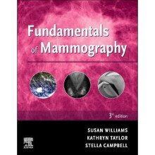 Fundamentals of Mammography - Williams, Sue - Paperback / sof -01/06/2021
