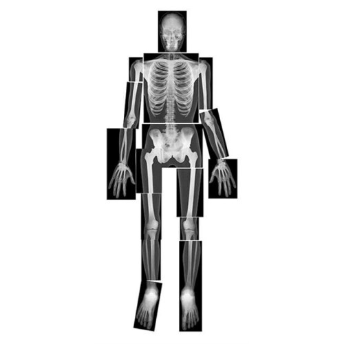 Roylco  Inc.  True To Life Human X-Rays