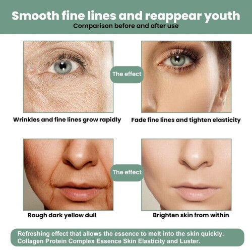 FLEMYE REN Advanced Collagen Boost Anti Ageing Serum Μειώνει τις ρυτίδες στο πρόσωπο 2