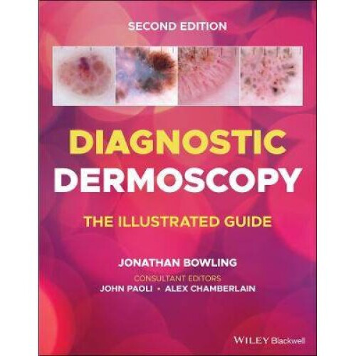 Diagnostic Dermoscopy - The Illustrated Guide