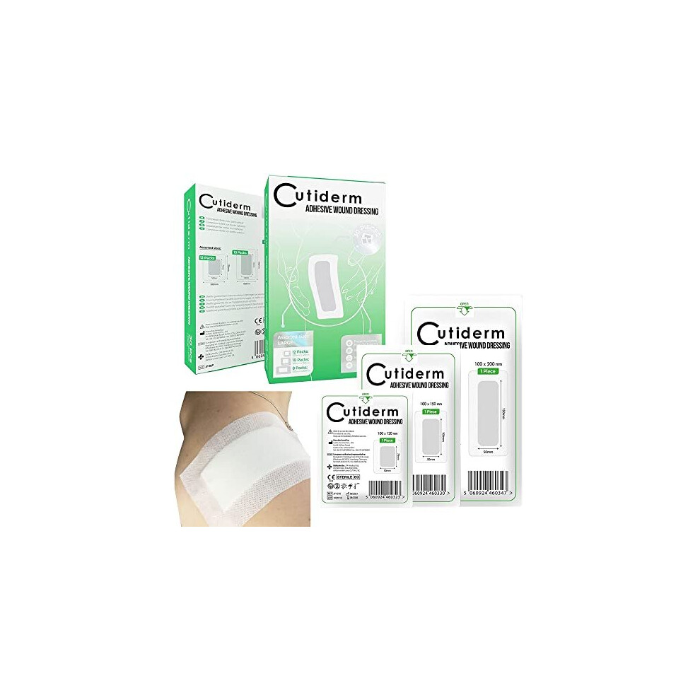 Cutiderm Pack Of 30 Large Assorted Adhesive Sterile Wound Dressings Suitable For Cuts And Grazes, Diabetic Leg Ulcers, Venous Leg Ulcers, Small