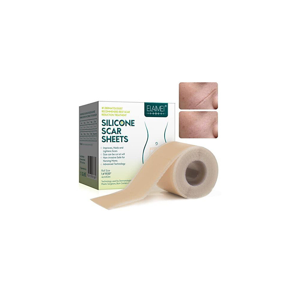 Zodenis Silicone Scar Sheets (1.6ÂX 120Â, 3M), Silicone Scar Tape, Scar Strips, Effective Silicone Scar Sheets For Surgical Scars, C-Section Surgery Scar,