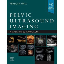 Pelvic Ultrasound Imaging: A Cased-Based Approach - Hall, Rebecca - Paperback / sof -27/08/2021
