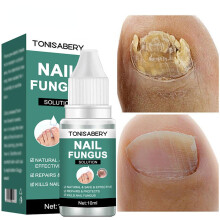 Nail Fungal Treatment Feet Care Essence Anti Infection Paronychia Onychomycosis