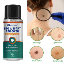 Skin Tag Remover Warts Remover Wart Cream Ct Foot Plaster Warts Skin Care Oil