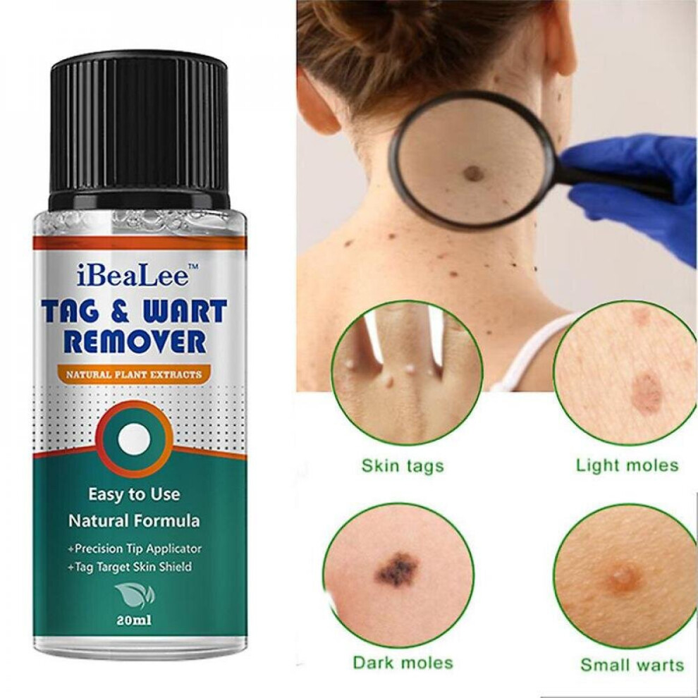 Skin Tag Remover Warts Remover Wart Cream Ct Foot Plaster Warts Skin Care Oil
