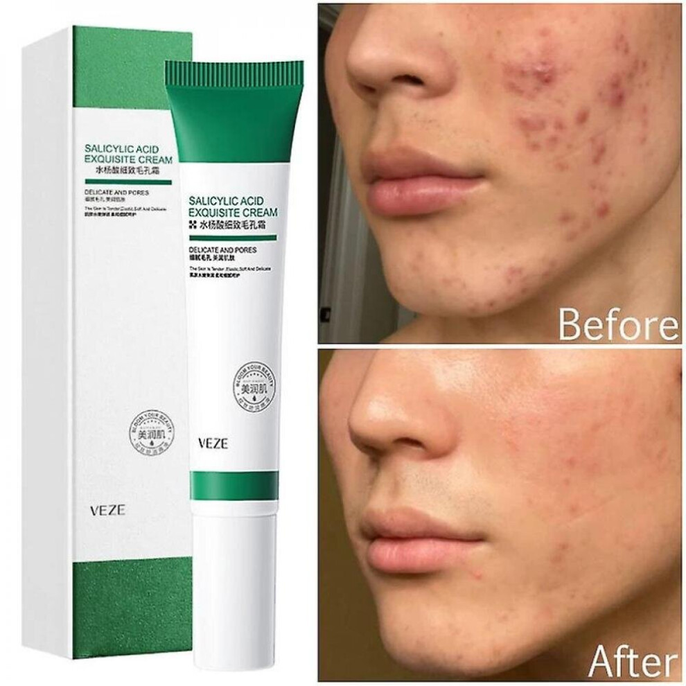 Salicylic Pores Refining Cream Improve Face S Cream Shrink Pore L Skin Care