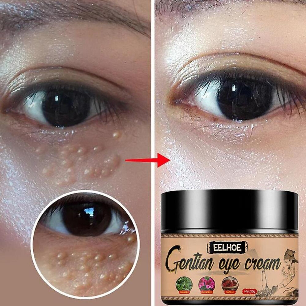 Remove Fat Granules Cream Improve Eye Bag En Lines Moisturize Anti-pufss Lift Firm Skin Care Serum