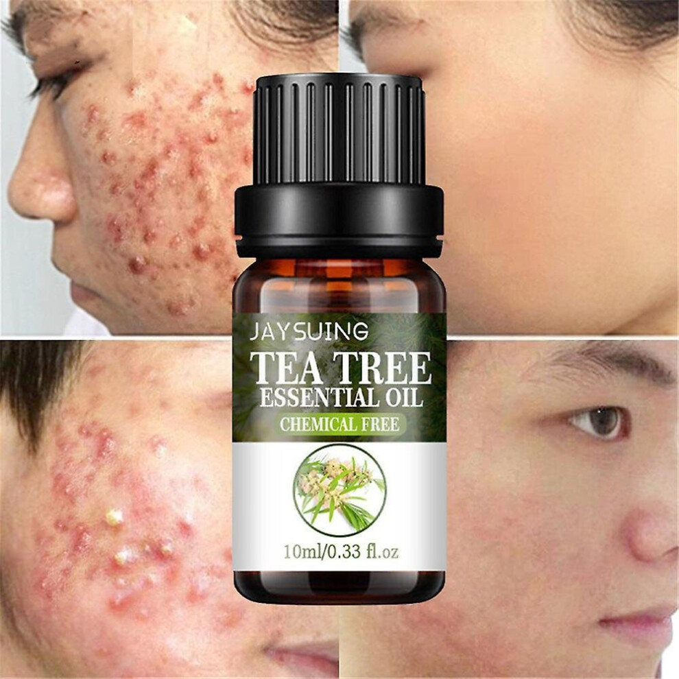 Tea Tree Remove Oil Anti- Serum Fade S S S Shrink Pores Oil Skin
