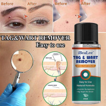 3pc Warts Remover Antil Wart Cream Skin Tag Remover Ct Plaster Wart