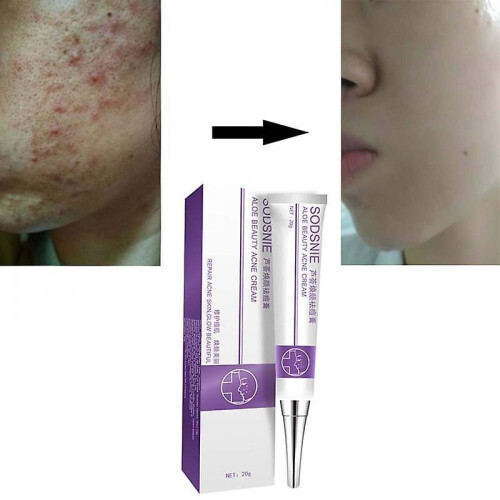 Sodsnie Vera L Cream Skin Care Rep Skin Women's Facial Cream 20g on OnBuy