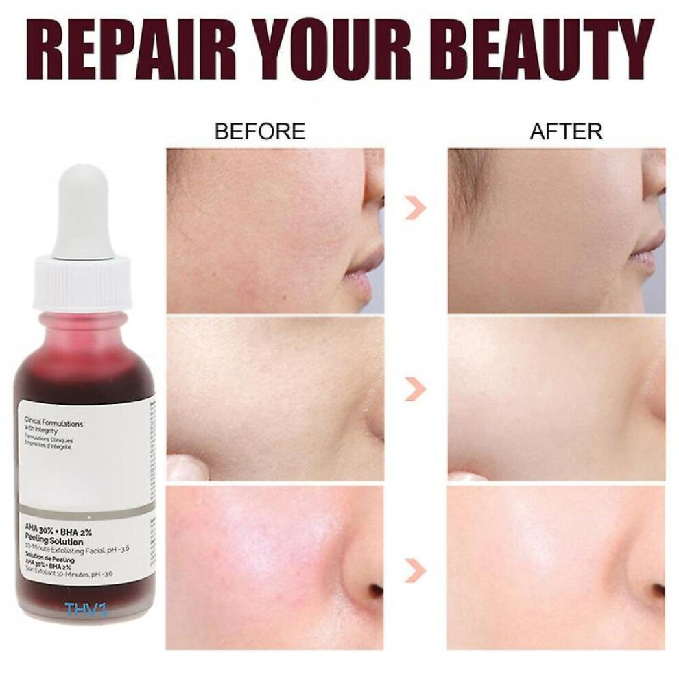 Face Solut Aha 30% + Bha 2% Makeup Ing Removing Serum Rep Hyaluronic Moisturizer Face Skin Care